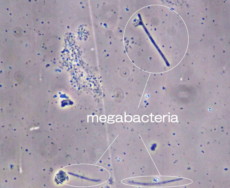 メガバクテリア症（めがばくてりあしょう）