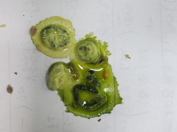 尿が緑