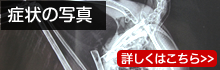 症状の写真